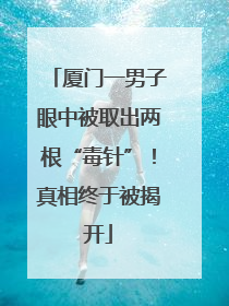 厦门一男子眼中被取出两根“毒针”！真相终于被揭开