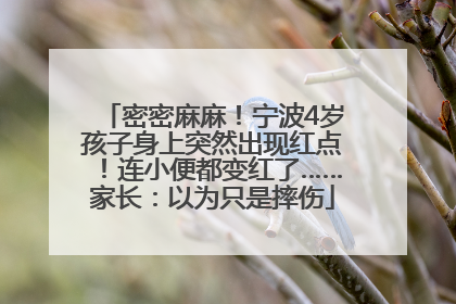 密密麻麻！宁波4岁孩子身上突然出现红点！连小便都变红了……家长：以为只是摔伤